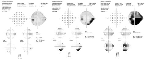 Visual Field's Instagram, Twitter & Facebook on IDCrawl