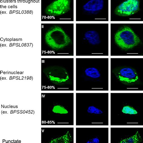 BPSS0180-induced puncta colocalize with the lysosome marker LAMP1. (A)... | Download Scientific ...