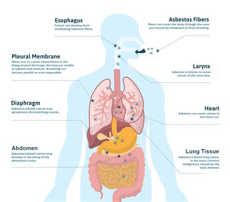 Basic Symptoms of Asbestos Exposure in San Diego| CVE Corp.