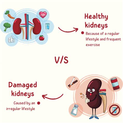 Kidney Stones: Symptoms, Causes, Types, and Treatments