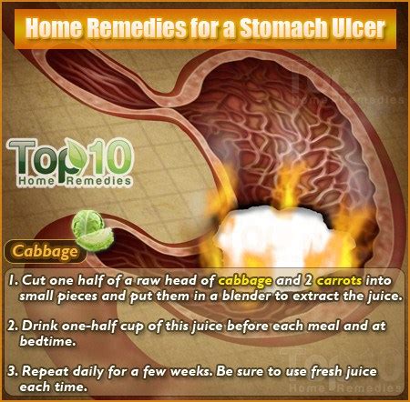 Home Remedies for a Stomach Ulcer ~ Mzizi Mkavu