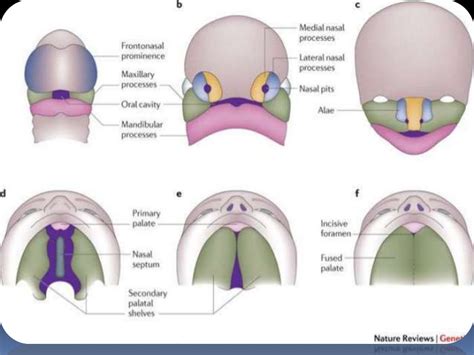 Pharyngeal arches 1