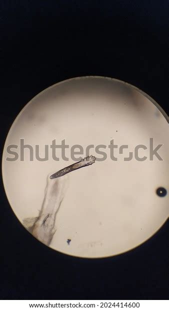 Demodex Mite Parasite Eyelashes Ophthalmology Stock Photo 2024414600 | Shutterstock