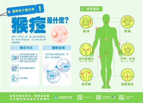 First two cases of locally acquired mpox reported - Taipei Times