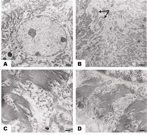 Bovine wart sample-Transmission electron microscopy (TEM) images of... | Download Scientific Diagram