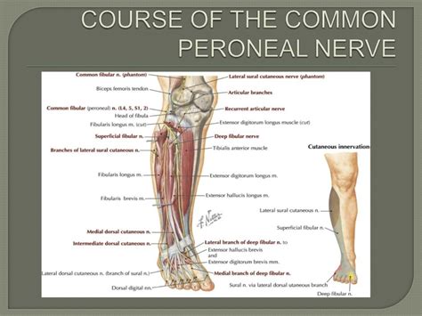 Common peroneal nerve lesions