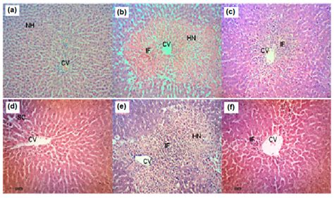 (a) Normal liver parenchyma. (b) Section of liver tissue treated with 3... | Download Scientific ...