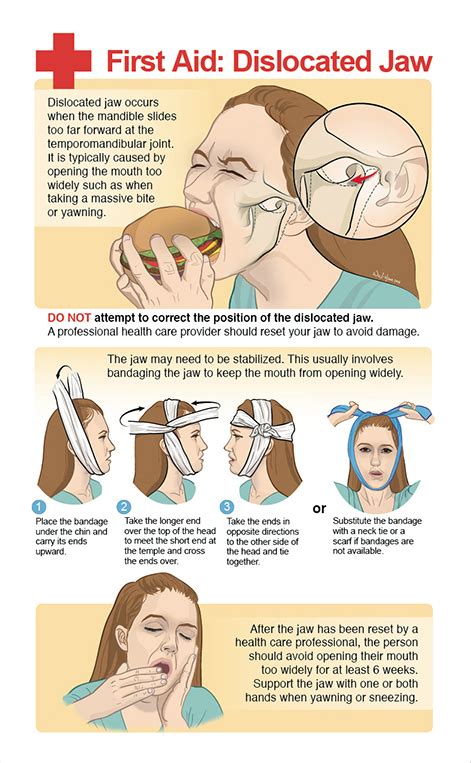 First Aid: Dislocated Jaw – I-Hsun Wu Biomedical Visualization