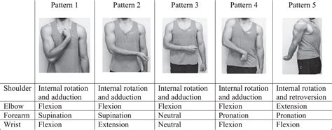 Upper Limb Spasticity