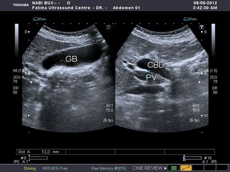 Pin on Abd Ultrasound 100 Mod 2