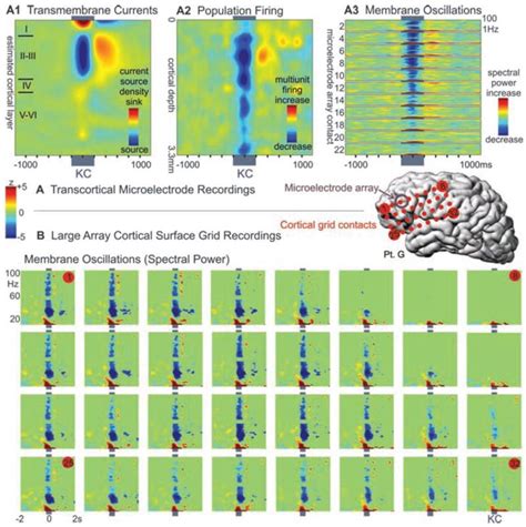 The Human K-Complex Represents an Isolated Cortical Down-State: The largest EEG artefact; sleep ...