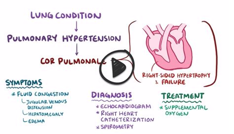 Cor pulmonale - Smarty PANCE