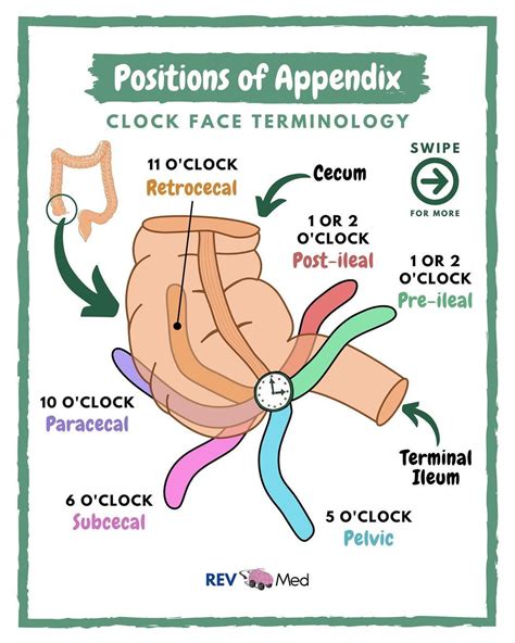 REV MED | Anatomy Lessons on Tumblr