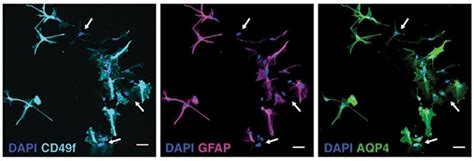 New Astrocyte Marker Allows Purification from Mixed Cultures | ALZFORUM