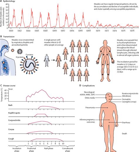 Measles - The Lancet