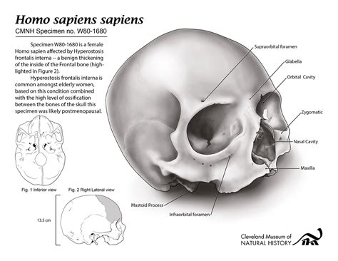 Homo Sapien Skull Drawing