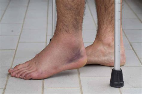 Ankle Sprain Exercises: Tips to a Faster Recovery! | PT Time with Tim