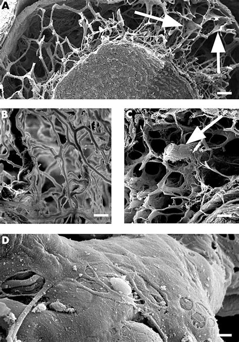 Architecture of arachnoid trabeculae, pillars, and septa in the subarachnoid space of the human ...