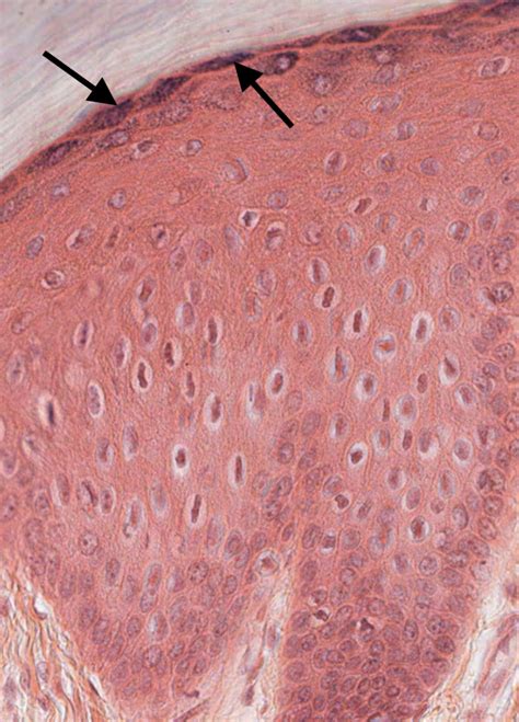 Integument Practice Quiz – Medical Histology – Jacobs School of Medicine