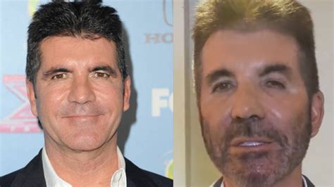 Simon Cowell Deletes Tweet After Fans Are Concerned About His Weird Face