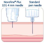 Know Your Needles