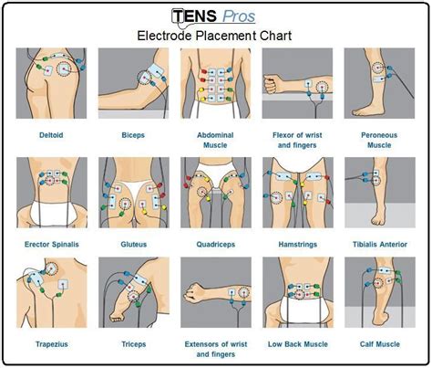 Image result for hip flexor tens placement | Ten unit, Tens electrode placement, Tens electrodes