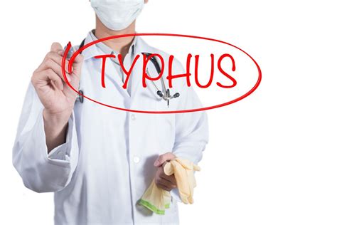 Causes, Symptoms, and Treatments of Typhus - Facty Health