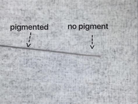 How can one identify a telogen hair? — Donovan Hair Clinic