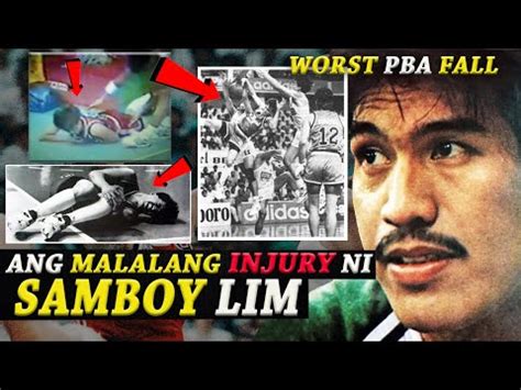 What Happened to Samboy Lim? Know Samboy Lim Cause of Coma - NAYAG Buzz