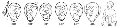 Belly Mapping - How to tell baby's position in the womb - Spinning Babies