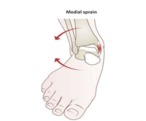 Medial Ankle Ligaments