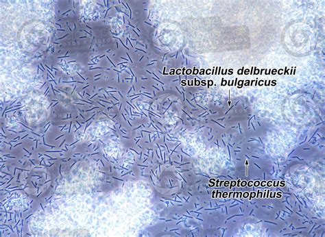 Lactobacillus delbrueckii subsp bulgaricus e Streptococcus thermophilus. Batteri. Contrasto di ...