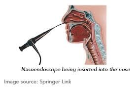 Nasoendoscopy A... - Hope Ear Nose & Throat Clinic