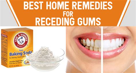 Best Home Remedies For Receding Gums - Remedies Lore