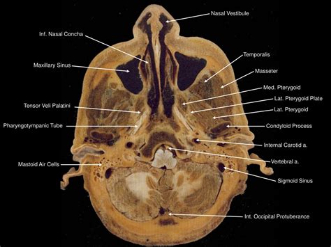 Nasal vestibulitis antibiotic treatment