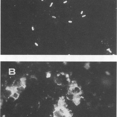 (PDF) Detection of Bacteroides fragilis, Bacteroides thetaiotaomicron ...