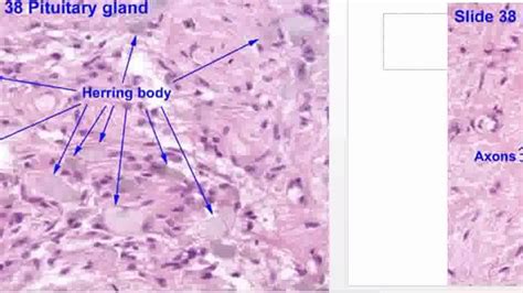 histology of posterior pituitary + blood supply of pituitary gland ...