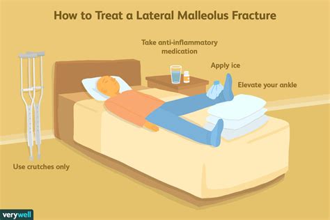 Lateral Malleolus Fracture Symptoms and Treatment