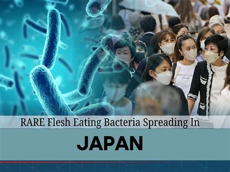 'Painful Death Within 48 Hours': Japan Sees Sharp Surge In Flesh Eating Bacteria Infection, Hong ...