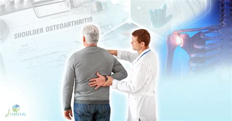 An Overview of Shoulder Osteoarthritis: Causes, Symptoms, and Treatments