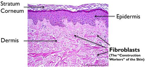 Activating Senescent Fibroblasts with Neodermyl® - Skin Management Sys - Skin Management System™