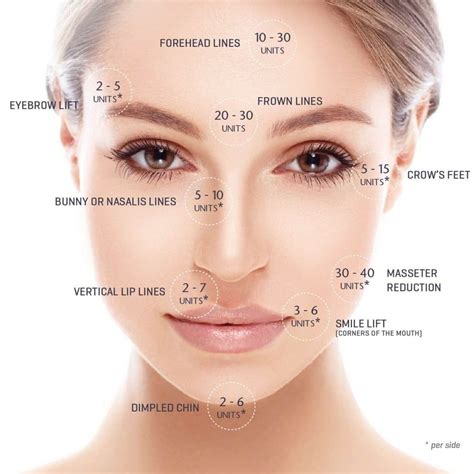 Botox unit amounts per area. #botox Facial Fillers, Botox Fillers, Dermal Fillers, Lip Fillers ...