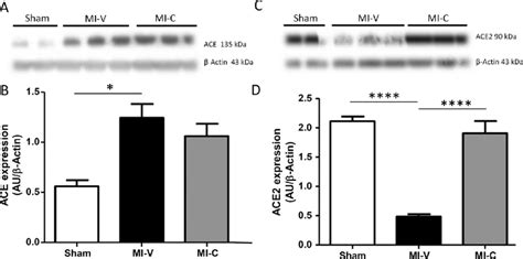 Protein expression of angiotensin converting enzyme (ACE) and ACE-2 in ...