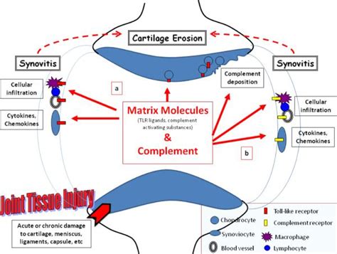 Pathophysiology Of Osteoarthritis Diagram