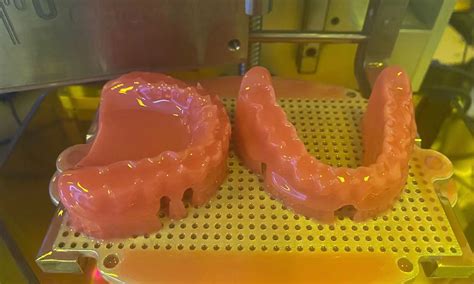 DLP 3D Printed Custom Full-mouth Resin Dentures - FacFox