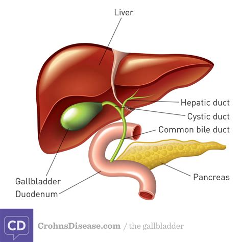 Gallstones & Crohn's disease | InflammatoryBowelDisease.net