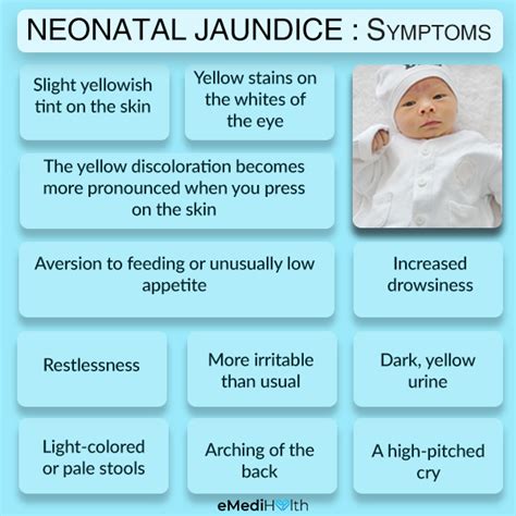 Jaundice in Newborns: Treatment and Care at Home