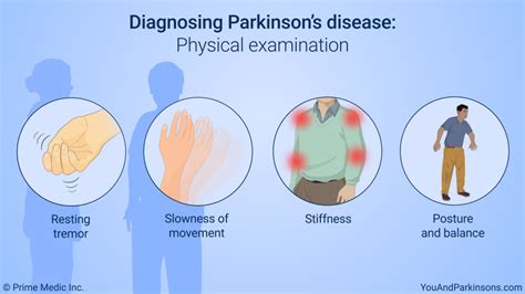 Slide Show - Diagnosis of Parkinson’s Disease