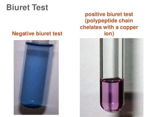 test du biuret svt