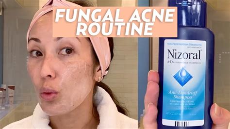 Treat Fungal Acne With This Skincare Routine | #SKINCARE - YouTube